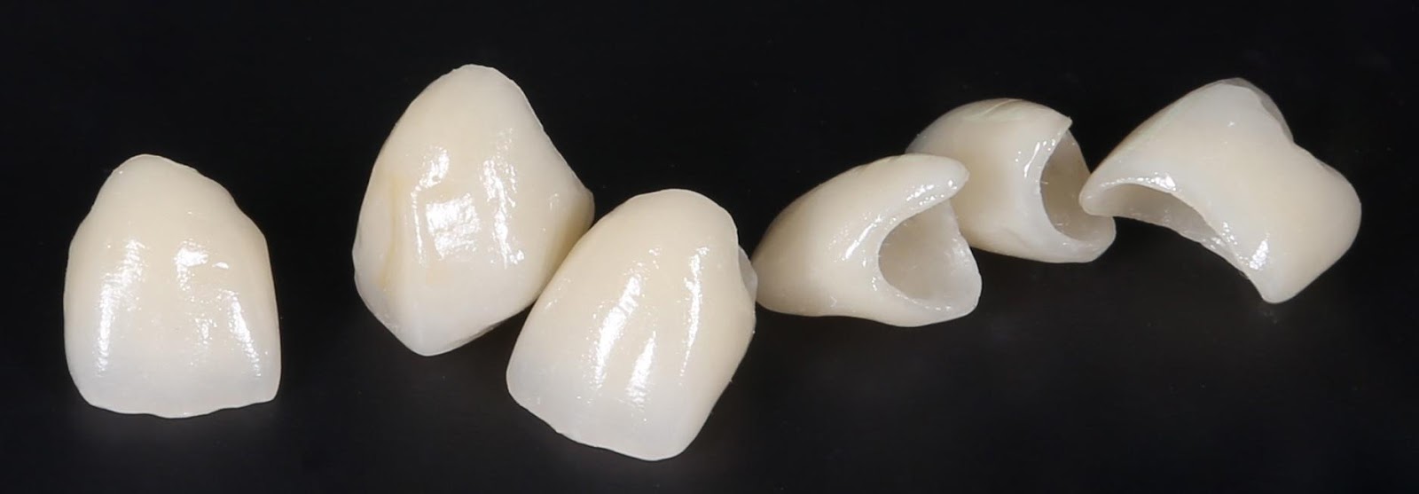 Фото: коронки из металлокерамики скрывают поврежденные или разрушенные зубы