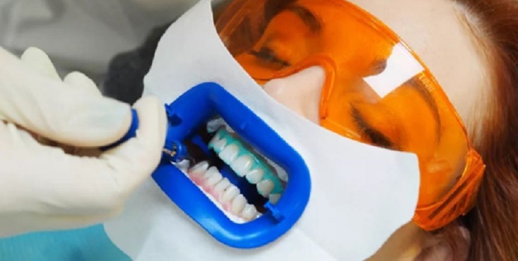 Польза отбеливания зубов